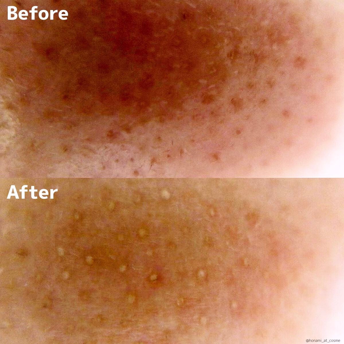 エマルジョンリムーバー 300ml/200ml/水橋保寿堂製薬/その他洗顔料を使ったクチコミ(7枚目)