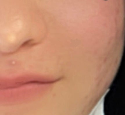 hinari on LIPS ãðã²ãšã€åã®æçš¿ã§ã®å¹æã«ã€ããŠã§ãâºïžðããããã²ã©ãã£ãæ..ãïŒ4æç®ïŒ