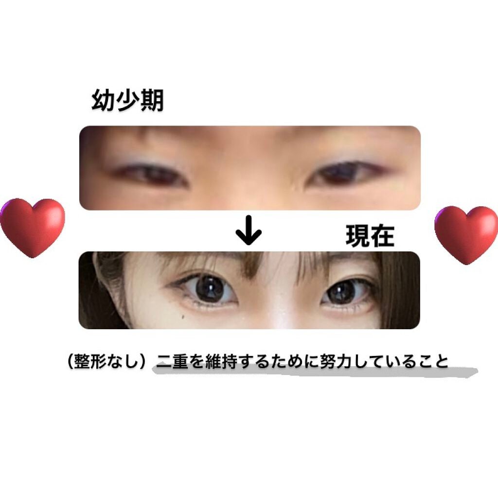 アイトーク/アイトーク/二重まぶた用アイテムを使ったクチコミ(1枚目)