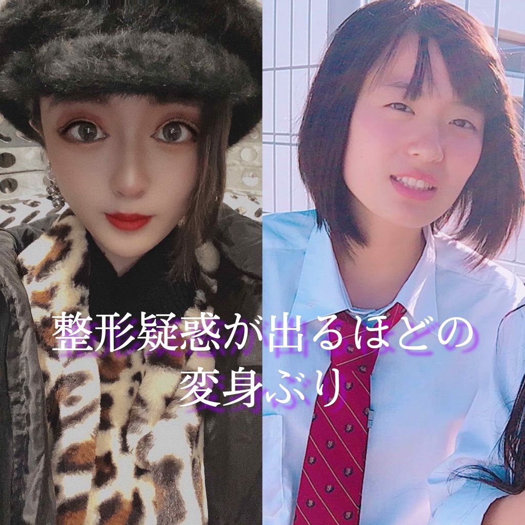 アイビューティー フィクサー WP/アストレア ヴィルゴ/二重まぶた用アイテムを使ったクチコミ(1枚目)