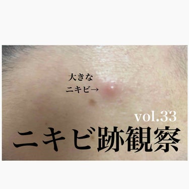 敏感肌用薬用美白美容液/無印良品/美容液を使ったクチコミ（1枚目）