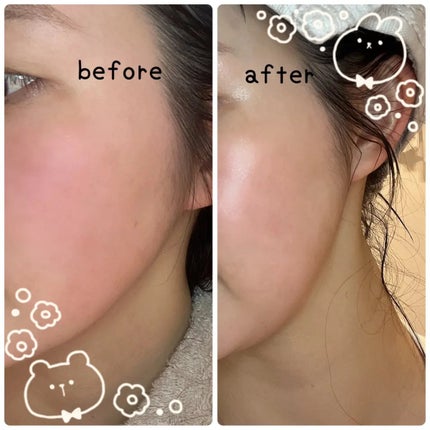 グルカミューンクリーム/VT/フェイスクリームを使ったクチコミ(4枚目)