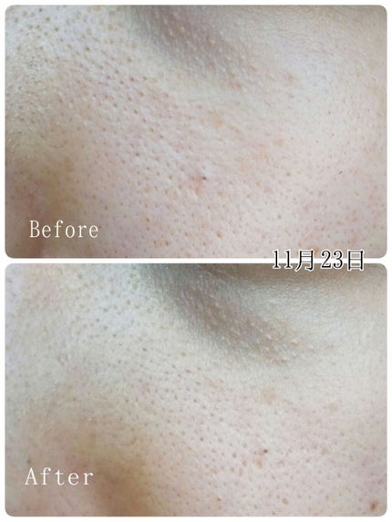 パワーマスク SP/ラッシュ/スクラブ・ゴマージュを使ったクチコミ(4枚目)