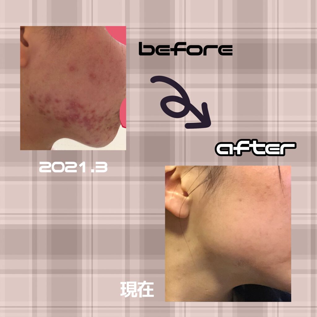 化粧水・敏感肌用・高保湿タイプ/無印良品/化粧水を使ったクチコミ(2枚目)