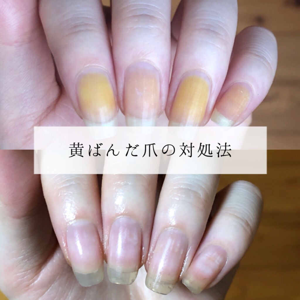 6ステップネイルケア/DAISO/ネイル用品を使ったクチコミ(1枚目)