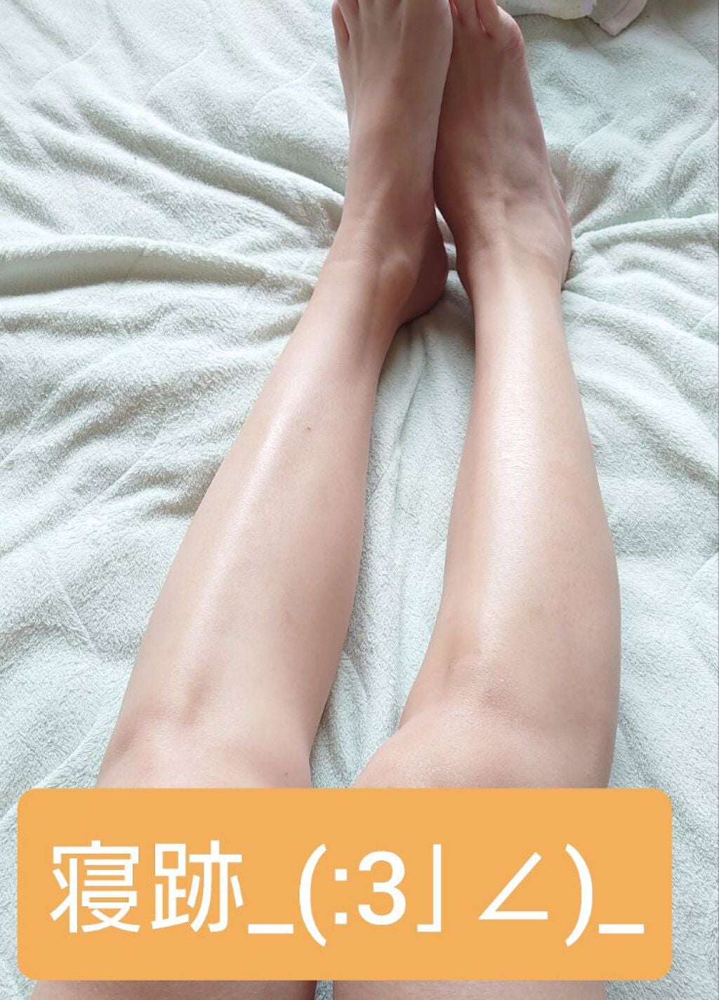 ヒップルン薬用ホワイトクリーム<医薬部外品>/PEACH JOHN/デリケートゾーンケアを使ったクチコミ(2枚目)