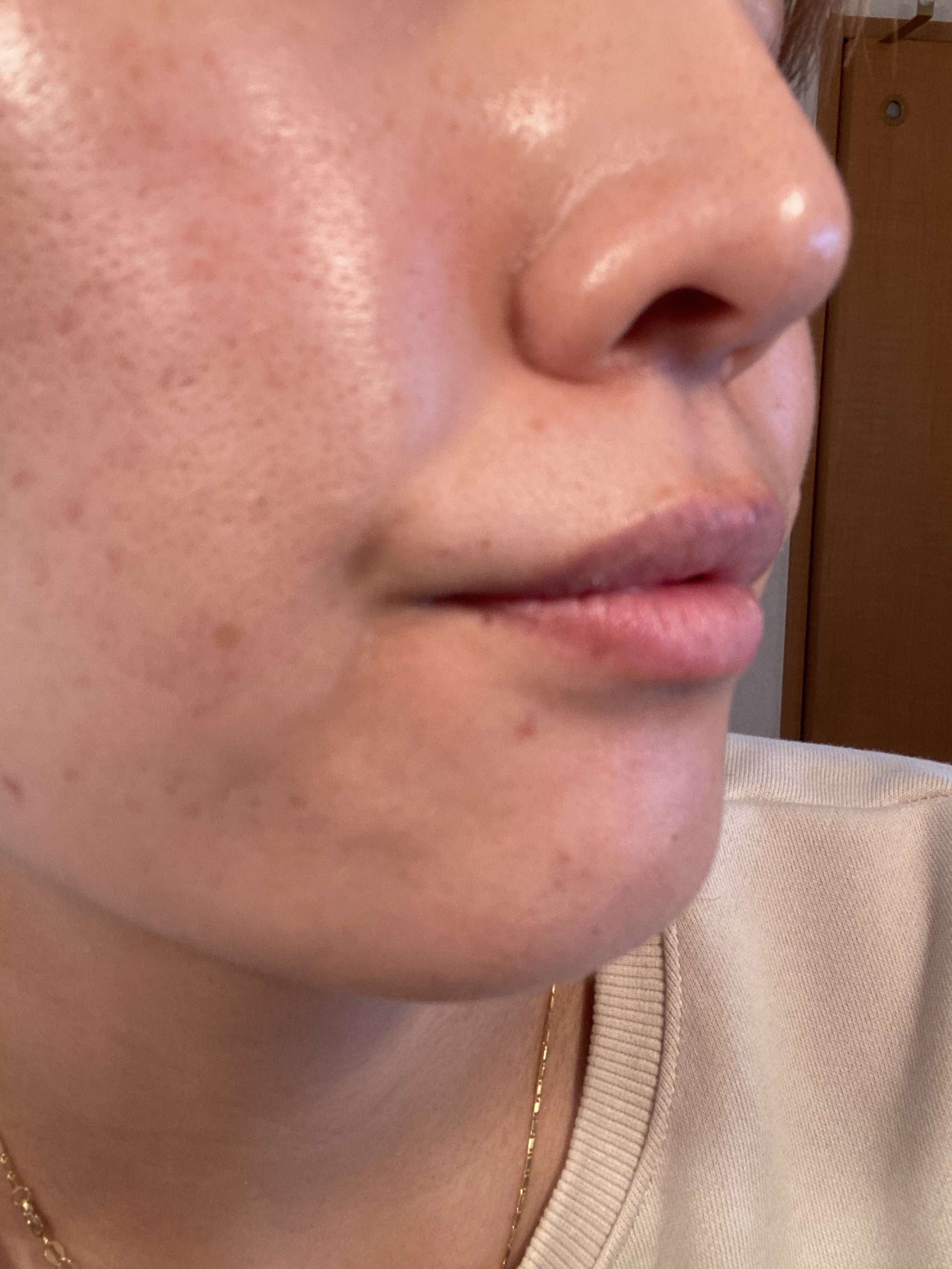 REJURAN モイスチャートリートメントマスク(23ml×5枚入り)/REJURAN COSMETICS/シートマスク・パックを使ったクチコミ（2枚目）