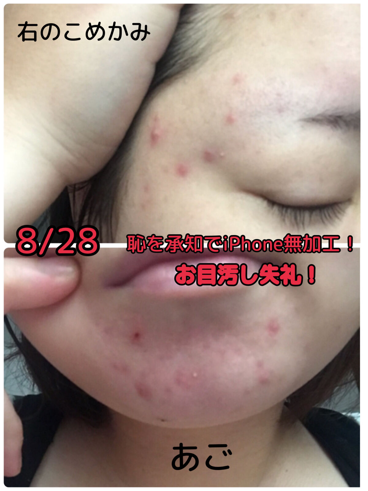 ドクダミ 77 スージングトナー/Anua/化粧水を使ったクチコミ（3枚目）