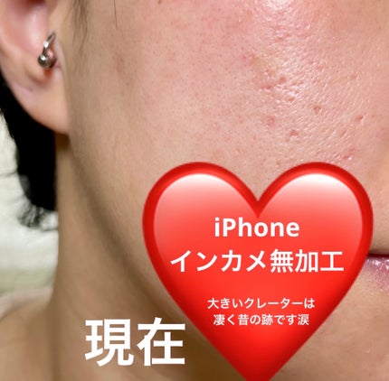 ライトリフレクティングセッティングパウダー プレスト N/NARS/プレストパウダーを使ったクチコミ(4枚目)