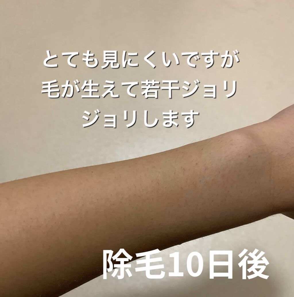 除毛クリームキット敏感肌用/エピラット/除毛クリームを使ったクチコミ(3枚目)