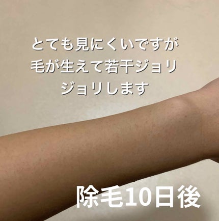 除毛クリームキット敏感肌用/エピラット/除毛クリームを使ったクチコミ(3枚目)