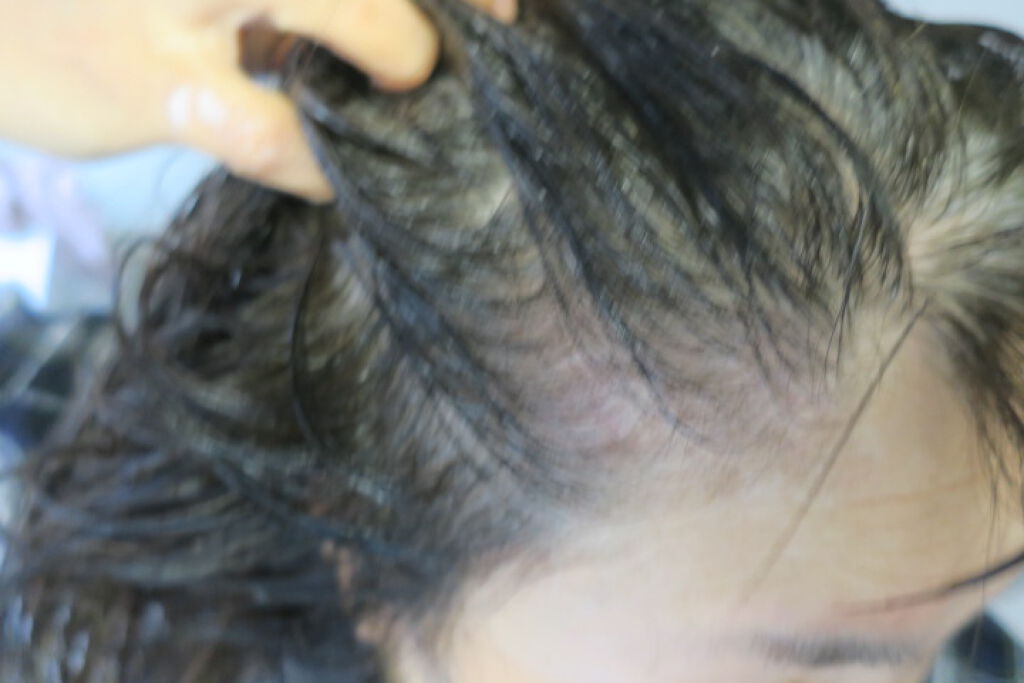 スカルプケアシステム クレンザー/ハイドレーター/スティーブンノル ニューヨーク/市販シャンプーを使ったクチコミ(3枚目)