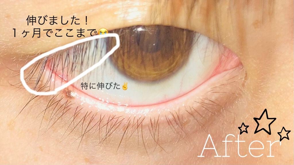 スカルプD ボーテ ピュアフリーアイラッシュセラム プレミアム/アンファー(スカルプD)/まつげ美容液を使ったクチコミ(6枚目)