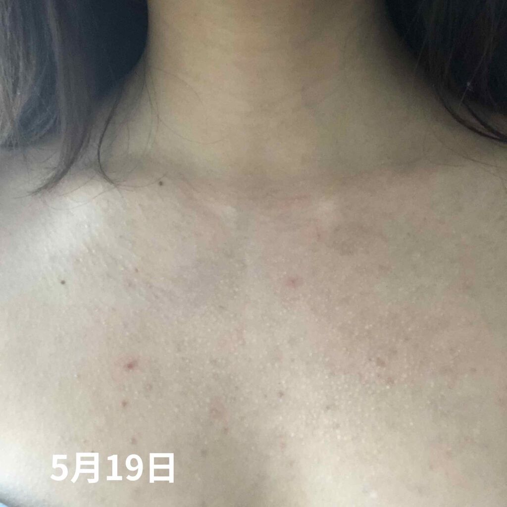 セナキュア(医薬品)/小林製薬/その他を使ったクチコミ（3枚目）