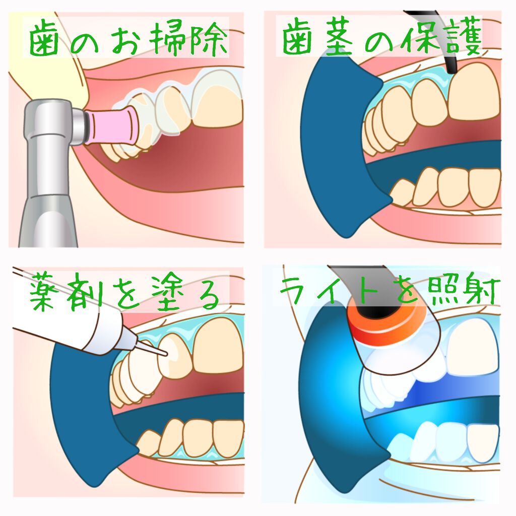 ティントデイリーリップバーム/rms beauty/リップティントを使ったクチコミ(2枚目)