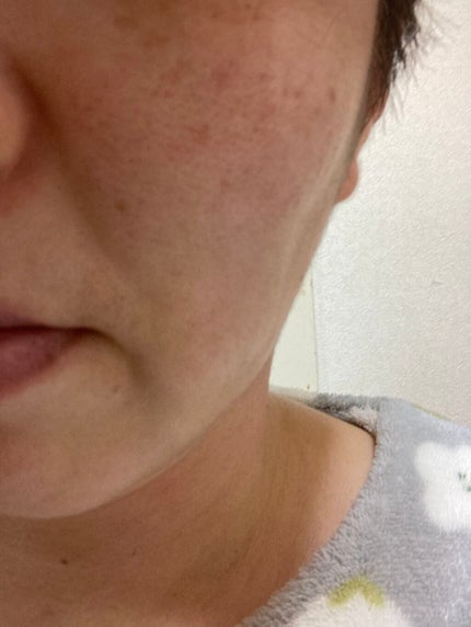 Renouve/株式会社アイザ/フェイスクリームを使ったクチコミ(4枚目)