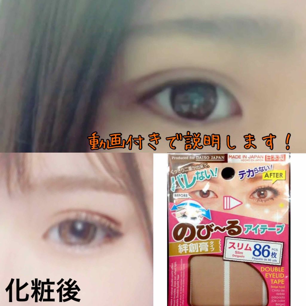 のびーるアイテープ(絆創膏タイプ、レギュラー)/DAISO/二重まぶた用アイテムを使ったクチコミ(1枚目)