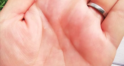 ネイチャーズフォー ヒーリングローション/Natures for/化粧水を使ったクチコミ(3枚目)