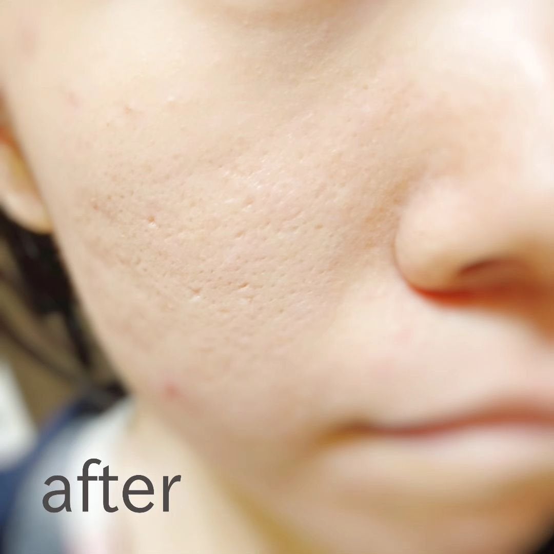 ピクジェリークセラムパウダリーBB-SP/Pesca(ペスカ)/パウダーファンデーションを使ったクチコミ(4枚目)