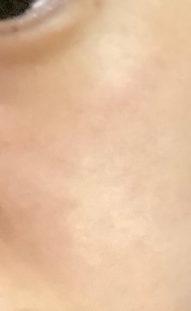 ハトムギ保湿ジェル(ナチュリエ スキンコンディショニングジェル)/ナチュリエ/美容液を使ったクチコミ（5枚目）