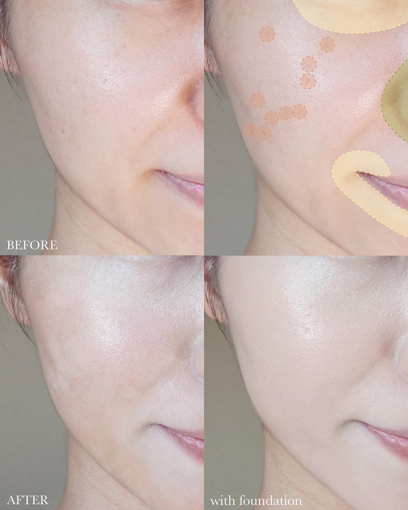 パーフェクトカバー コンシーラーパレット/Dear.A/パレットコンシーラーを使ったクチコミ(5枚目)