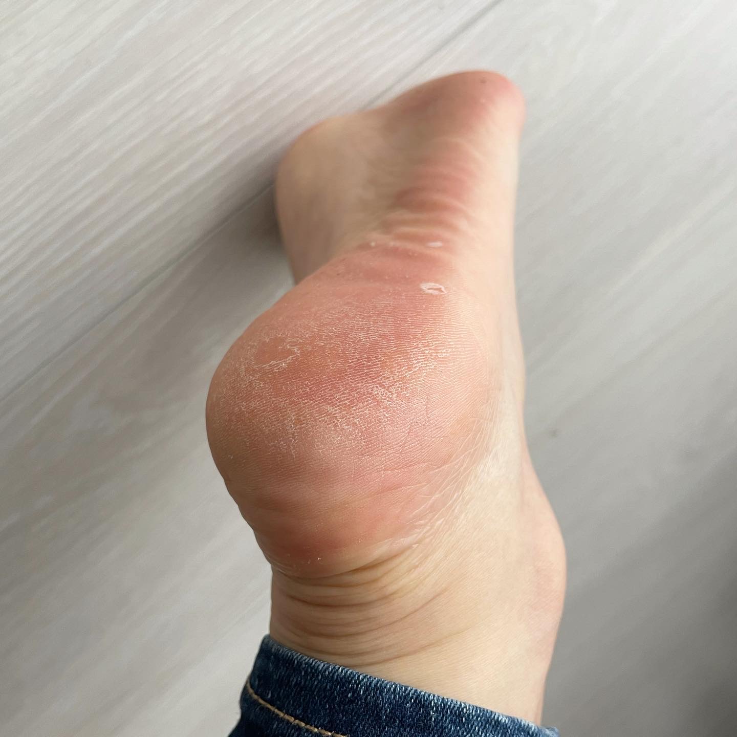 美白乃美人ピーリングジェル/ブレーンコスモス/ピーリングを使ったクチコミ（3枚目）