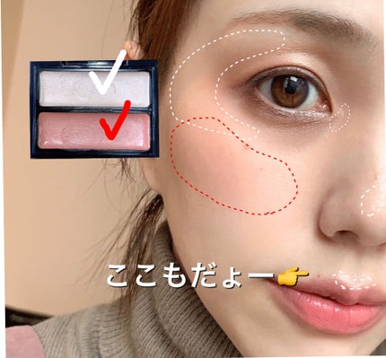 ダーマパワーX リップエッセンス/オバジ/リップ美容液を使ったクチコミ(7枚目)