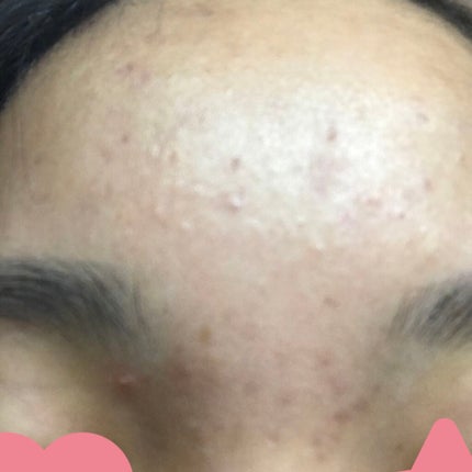 âð» on LIPS ãä»ãããã«æ©ãã§ããŸãð10代ãªã®ã§ããããææ¥æãããã§ãð°..ãïŒ4æç®ïŒ