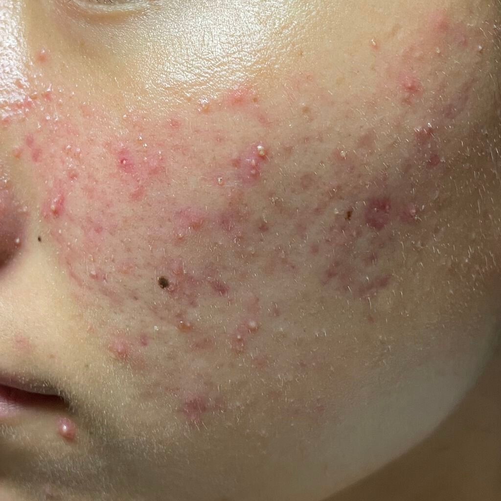 3番 すべすべキメケアセラム/numbuzin/美容液を使ったクチコミ(1枚目)