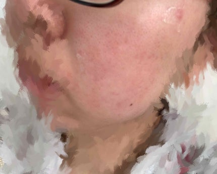 ぽか on LIPS 「🚨🚨🚨🚨🚨閲覧注意です🚨🚨🚨🚨🚨🚨もう一度言います。閲覧注意で..」(4枚目)