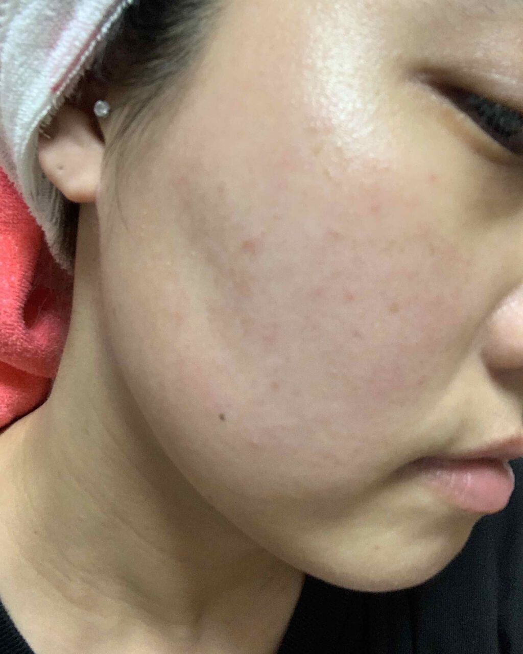 ᐠ( ᐛ )ᐟᐠ( ᐖ )ᐟ on LIPS 「今日めっちゃ調子いいです🥰ニキビ予防にもなるらしいのでべピオゲ..」(1枚目)