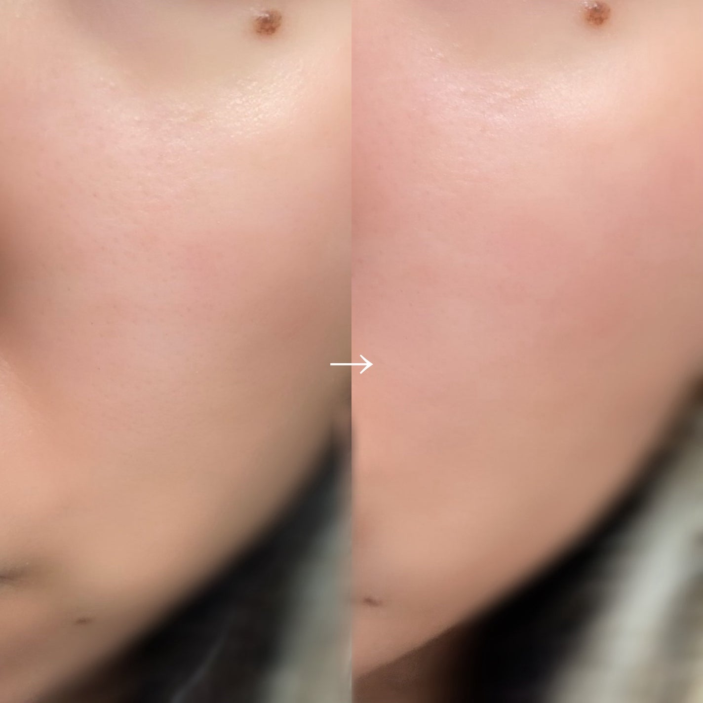 ボーンパンテノールピールトナー/SAM'U/化粧水を使ったクチコミ(5枚目)