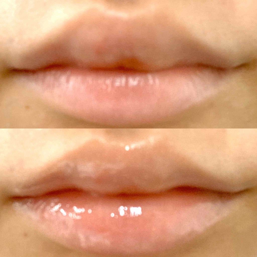 ボリュームリップセラム/AirPORULE/リップ美容液を使ったクチコミ（2枚目）