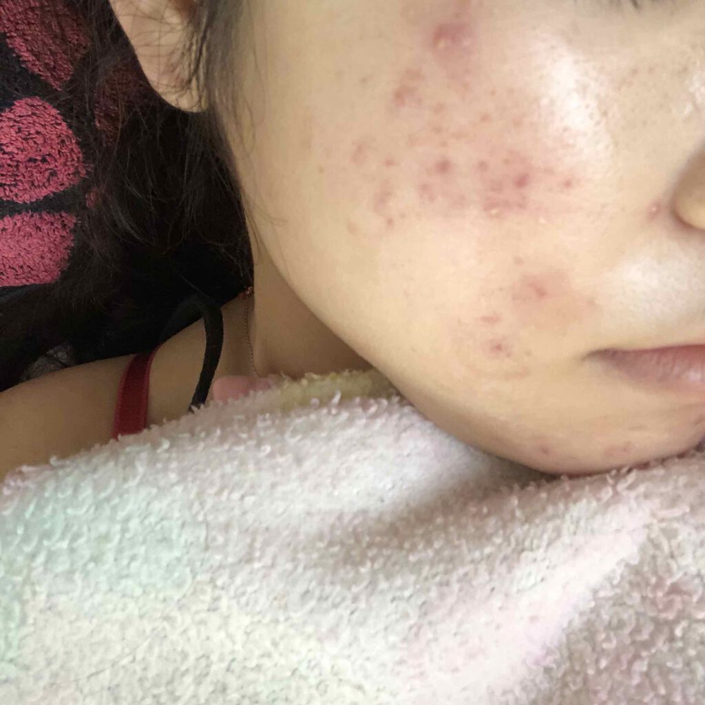 orange_perfume_2opm on LIPS 「こんにちは️️️⛅️今日でちょうど塗り始めて1週間が経ちました..」(2枚目)