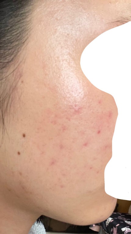 㪠㪠ð§žâ¡ on LIPS ããããæ¥èš7é±éç®2021/03/25ææŽé¡æããŒãããã¹ã¿é..ãïŒ4æç®ïŒ