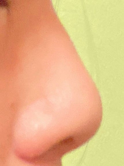 みんみみ on LIPS 「⚠️鼻の写真が写ります。 苦手な方は閲覧をお控えください。初め..」(3枚目)