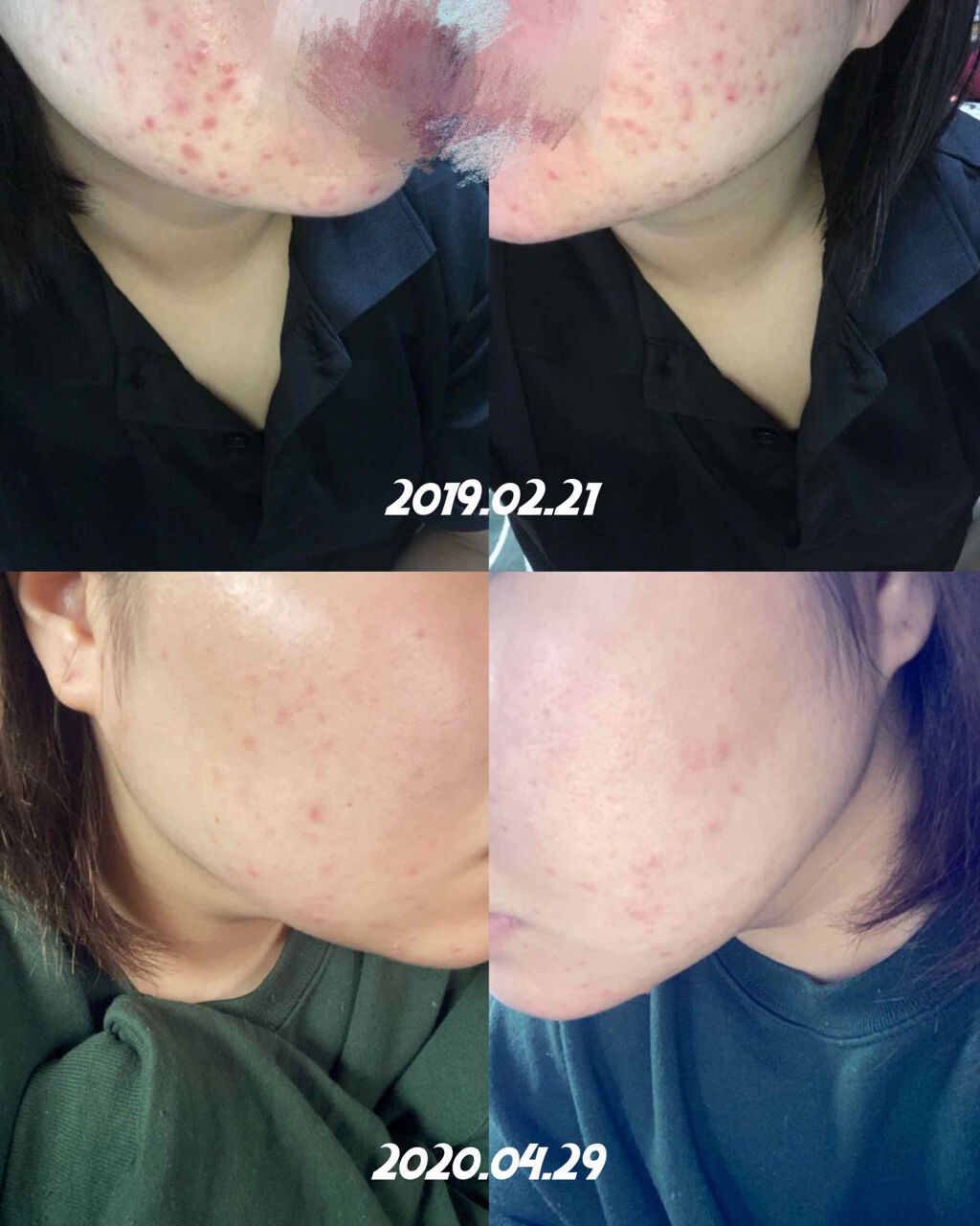 ドクタージャルト シカペアセラム	/Dr.Jart＋/美容液を使ったクチコミ（2枚目）