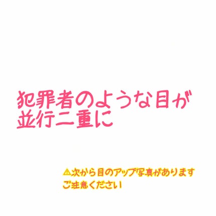 のびーるアイテープ(絆創膏タイプ、レギュラー)/DAISO/二重まぶた用アイテムを使ったクチコミ(1枚目)