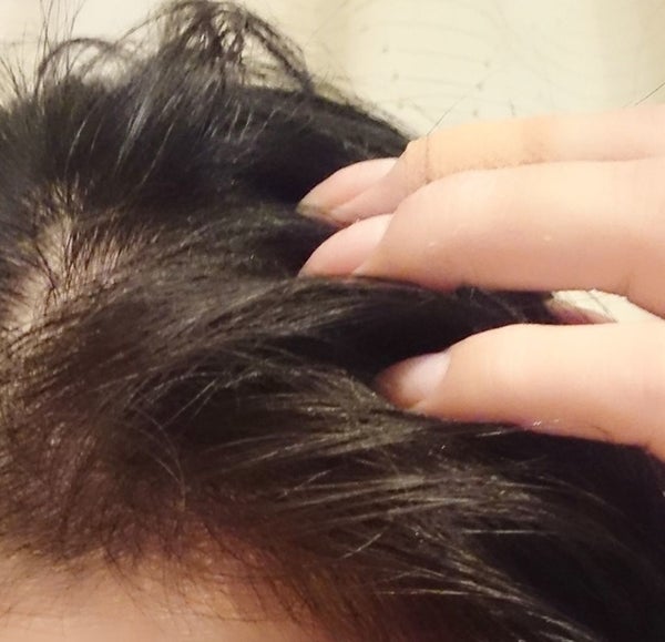 マイナチュレ 無添加育毛剤/マイナチュレ/頭皮ローション by こころん❤