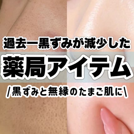 小鼻つるり筆/ツルリ/その他スキンケアグッズを使ったクチコミ(1枚目)