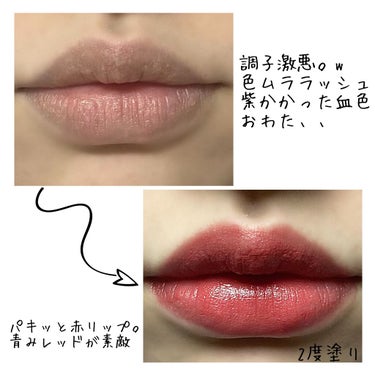 misoko on LIPS 「青みピンクが激かわ、、💓SUQQUのブルベ大勝利レップ😍｡*❤..」（3枚目）