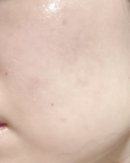 AQ アブソリュート エマルジョン マイクロラディアンス Ⅱ/DECORTÉ/乳液を使ったクチコミ(3枚目)