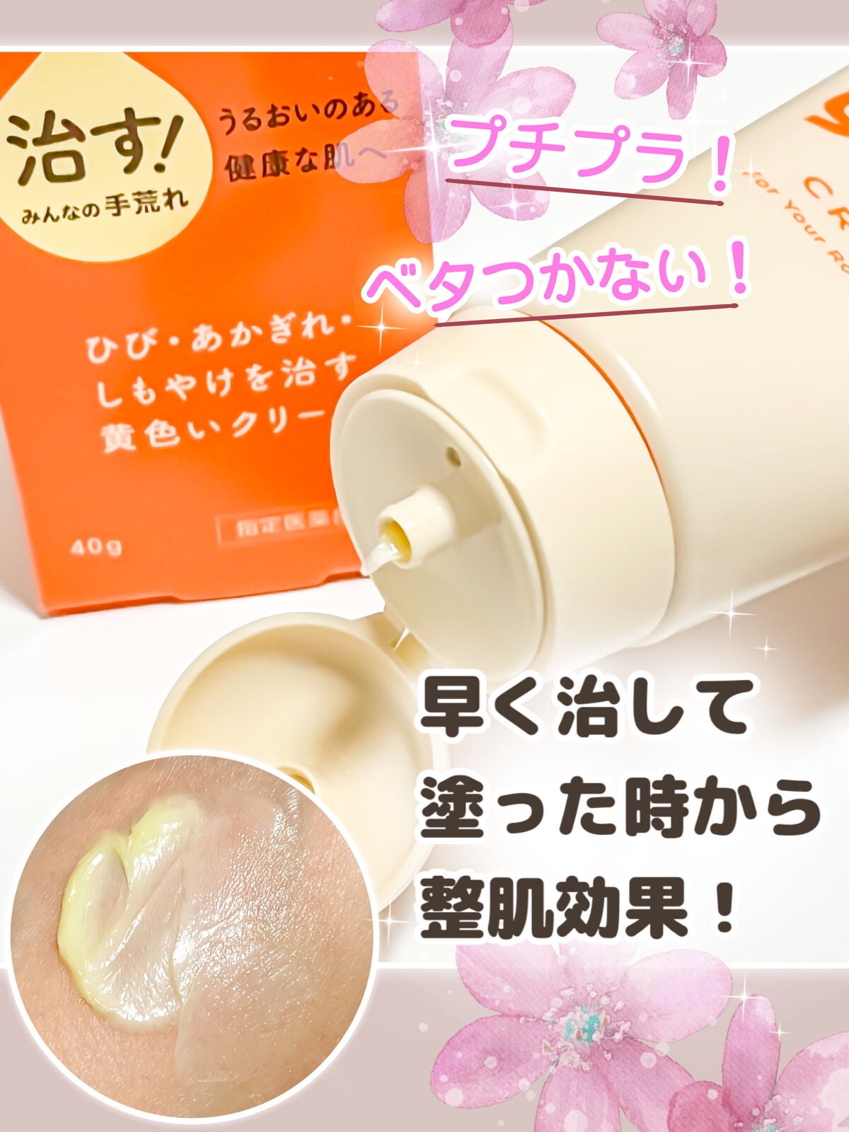 ユースキンA ミッフィーチューブ/ユースキン/ハンドクリームを使ったクチコミ(1枚目)