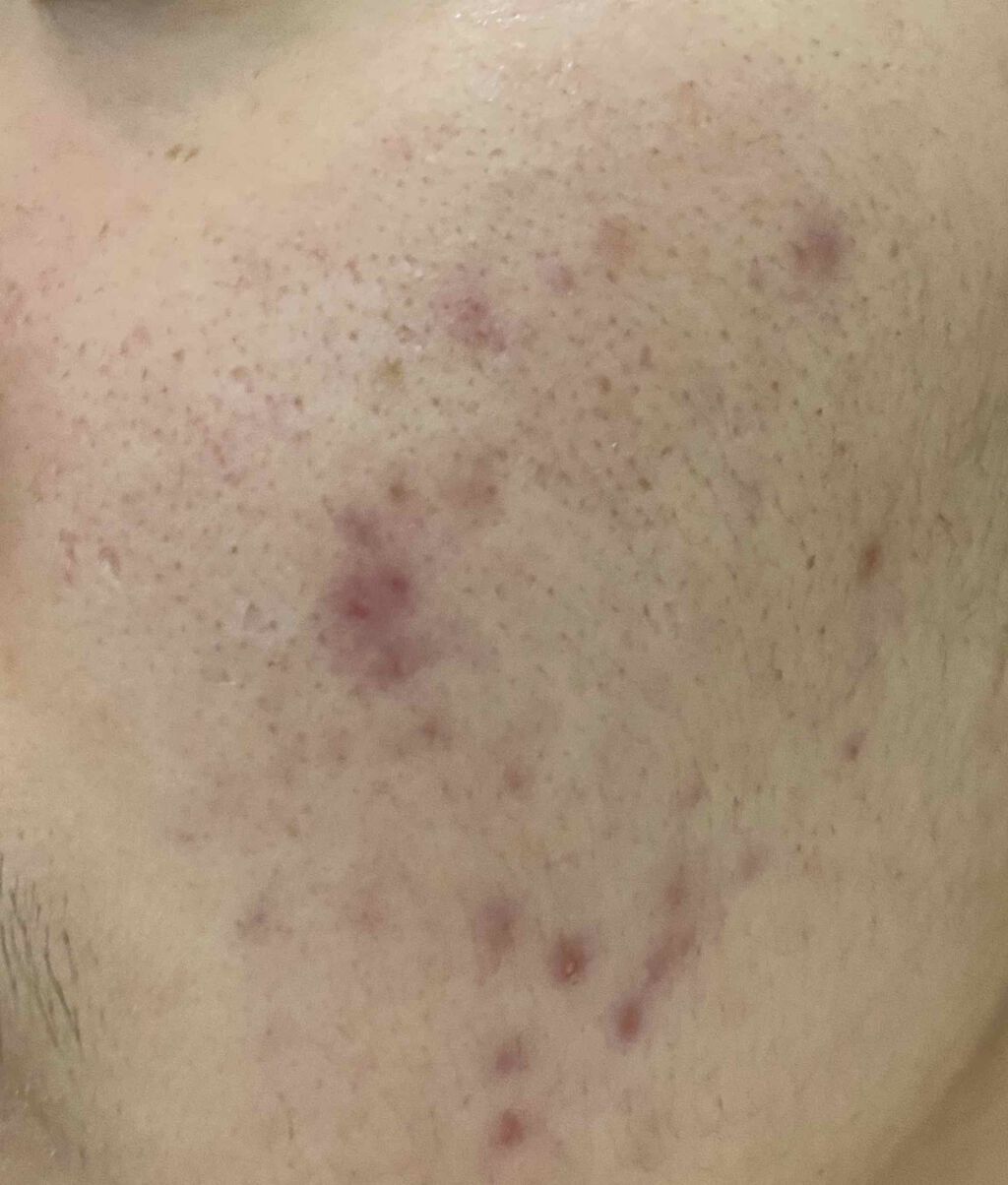 Cセラム/b.glen/美容液を使ったクチコミ（3枚目）