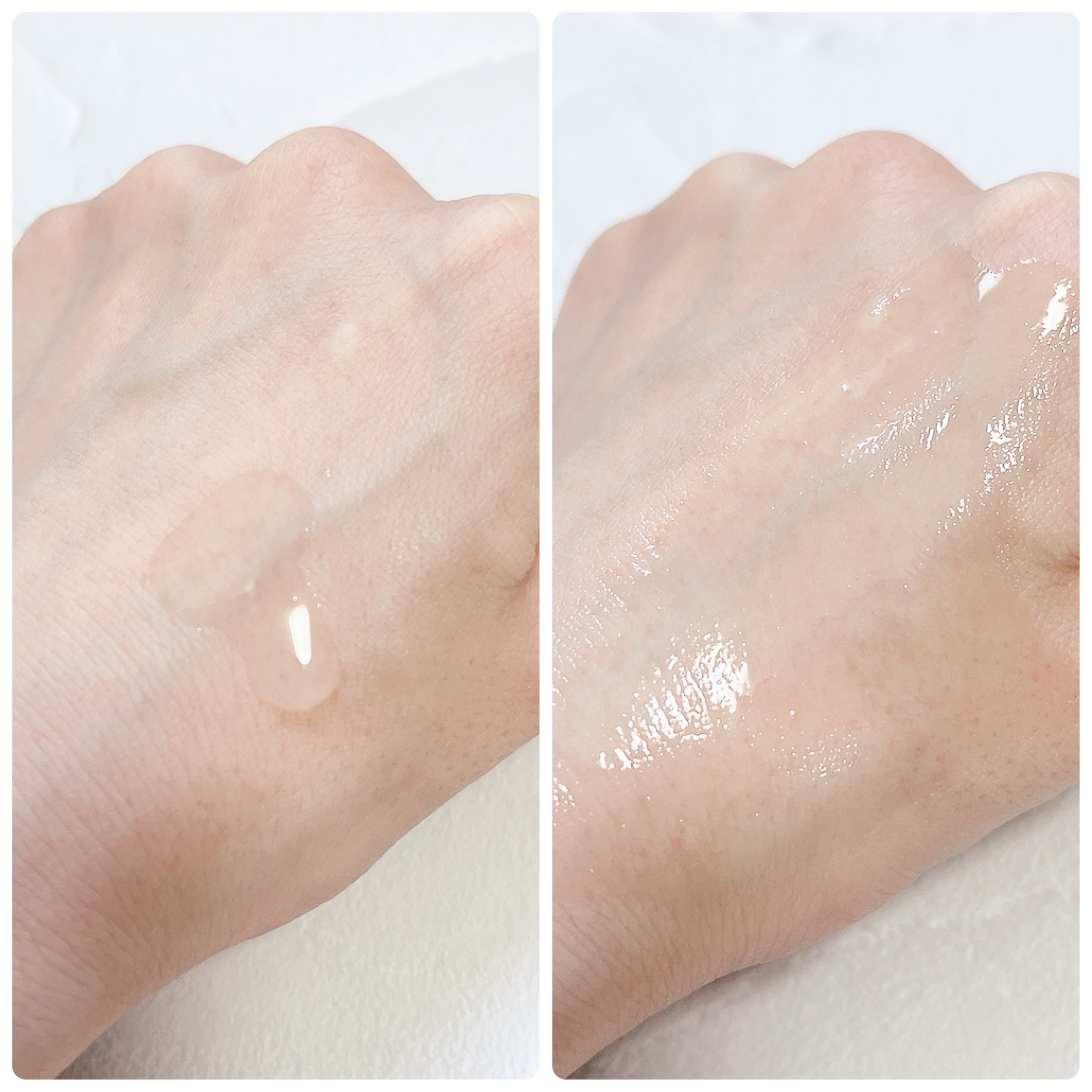 VC ホワイトピールセラム/SKIO/ブースター・導入液を使ったクチコミ（3枚目）