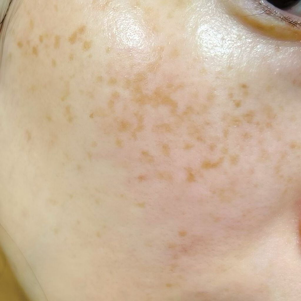 THE CICA 4.0 デイリーマスク/SNP/シートマスク・パックを使ったクチコミ(4枚目)