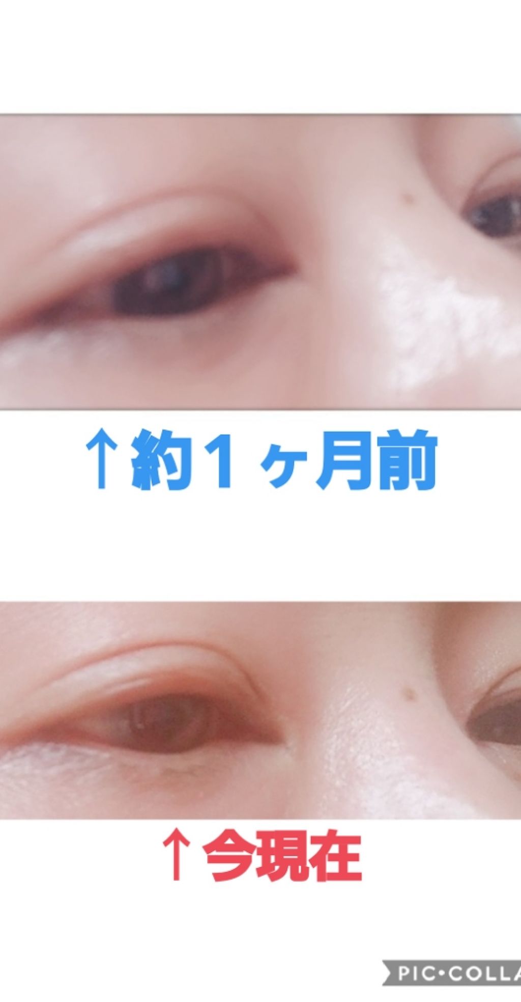 アイラッシュセラム|PHOEBE BEAUTY UPの辛口レビュー「まつ毛美容液