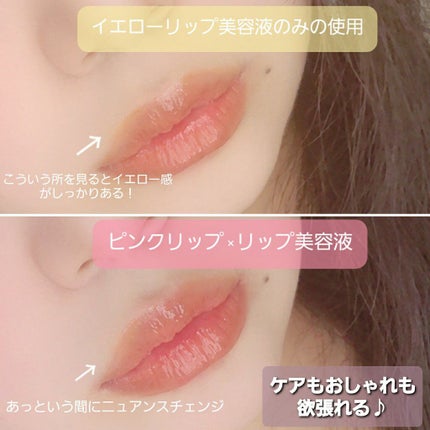 リップ美容液/WHOMEE/リップ美容液を使ったクチコミ(3枚目)