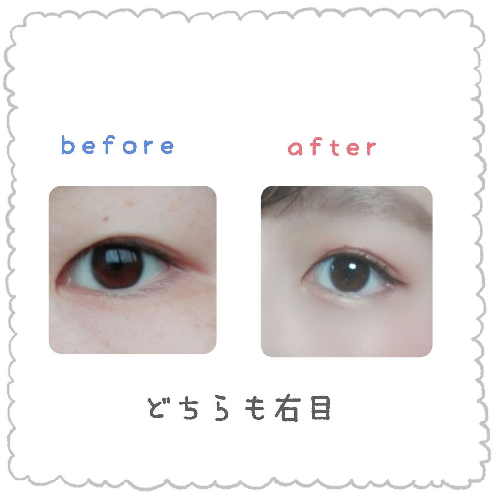 ワンダーアイリッドテープ Extra/D-UP/二重まぶた用アイテムを使ったクチコミ（2枚目）
