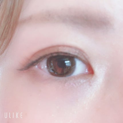 二重整形/その他を使ったクチコミ(2枚目)